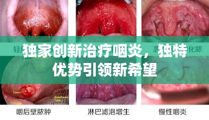 独家创新治疗咽炎,独特优势引领新希望